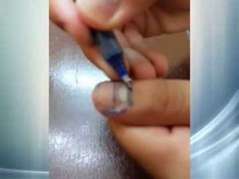 أسهل طريقة لعلاج ألم الأسنان