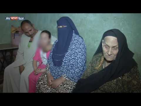 بالفيديو مريم تعاني من ورم خطير في الوجه