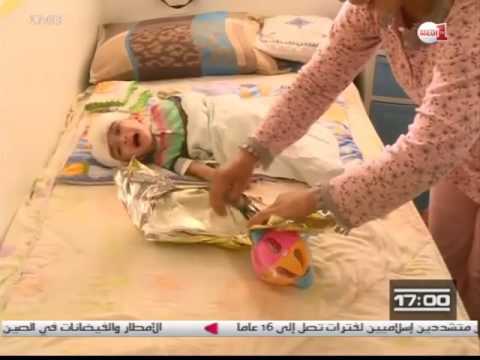 بالفيديو المرضى في مستشفى ابن سيناء