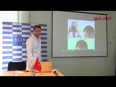 شاهد مشاهير في عالم الكرة والغناء قاموا بعملية زراعة الشعر