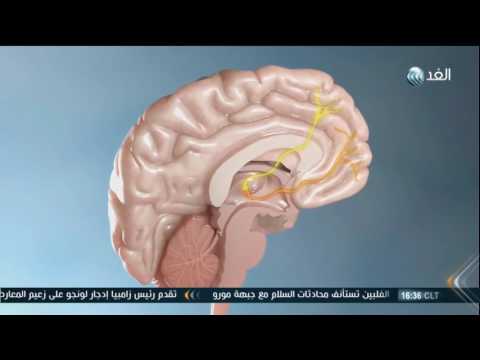 شاهد التمارين الرياضية  لعلاج أعراض الشيزوفرينيا