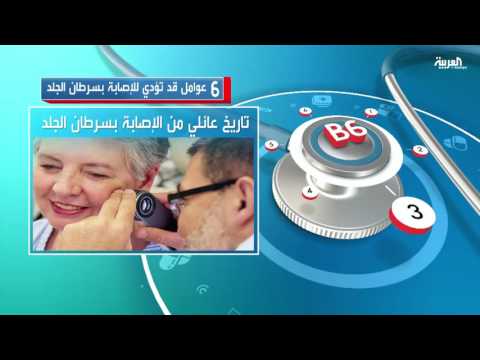 بالفيديو 6 عوامل تؤدي للإصابة بسرطان الجلد