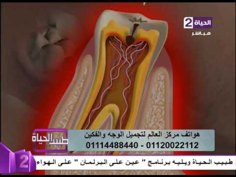 شاهد نصيحة لتجميل الأسنان عنالليزرلتجميل الأسنان