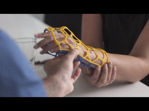 بالفيديو طريقة جديدة لمعالجة الكسور