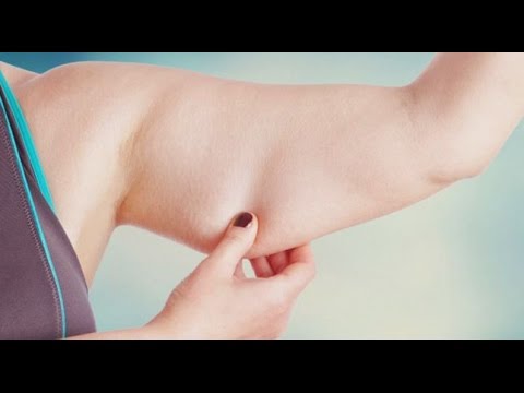 اهمية جراحة شد الجسم بعد عمليات السمنة