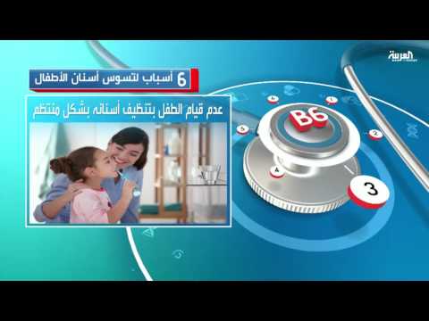 تعرف على 6 أسباب لتسوس أسنان الأطفال