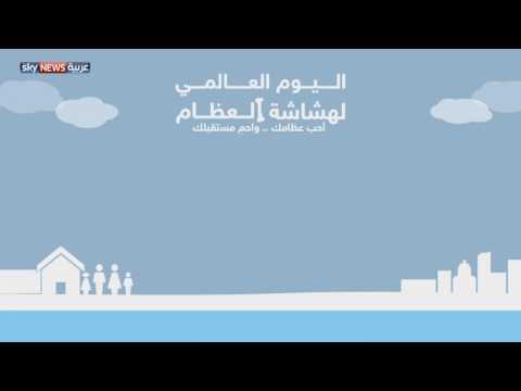 بالفيديو العالم يحتفل باليوم العالمي لهشاشة العظام