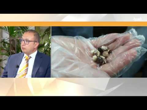 بالفيديو الإكثار من الماء يجنّبك التعرّض إلى حصى الكلى