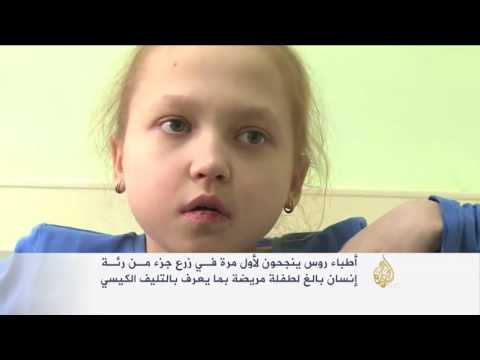 شاهد نجاح عملية لزراعة جزء من رئة إنسان