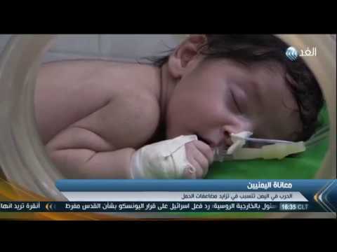 بالفيديو تزايد حالات الوفاة لدى الأطفال حديثي الولادة في اليمن