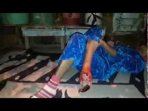 شاهد مواطنة معاقة تموت في صمت في منزلها