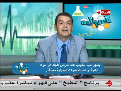 شاهد علاقة تكيسات المبايض بحب الشباب