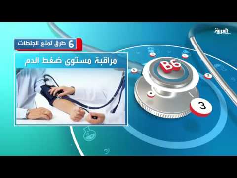 تعرَّف على أفضل 6 طرق لمنع الإصابة بالجلطات