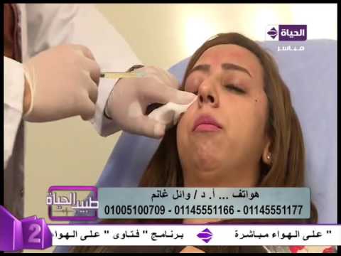 بالفيديو  تقنية البلازما ودورها في إعادة نضارة البشرة