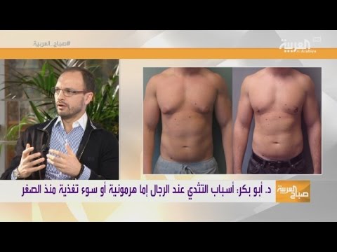 شاهد التثدي عند الرجال مشكلة محرجة وحلها بالليزر