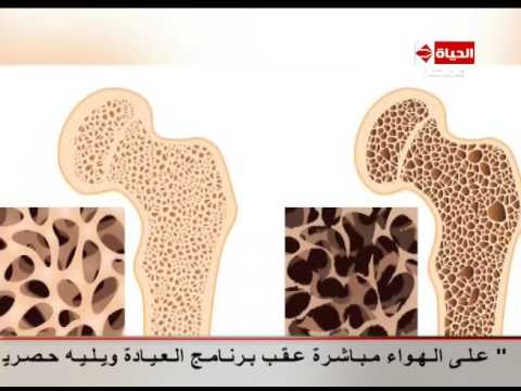 شرح تفصيلي بالصور للمفاصل بعد حدوث الإصابات بها