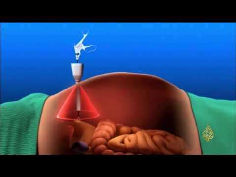 تقنية مغناطيسية تقلل من مخاطر العمليات