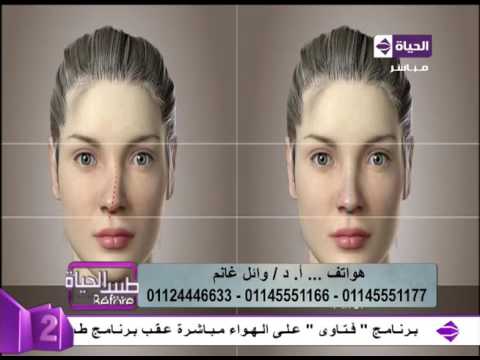 شاهد فيديو يوضّح كيفية تنفيذ عملية تجميل الأنف
