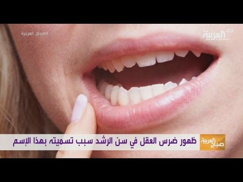 شاهد عدم توفر مساحة في الفم من أبرز مشاكل ضرس العقل