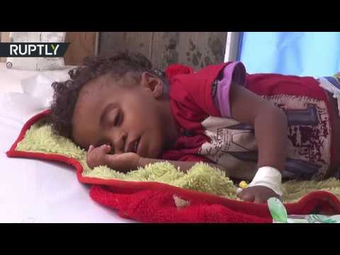 بالفيديو  الكوليرا تفتك بأكثر من 100 يمني وتصيب الآلاف