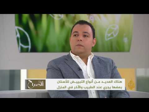 مقابلة مع الدكتور كريم أبو العينين حول تبييض الأسنان