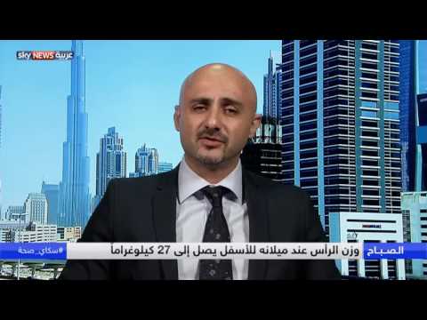 شاهد معنى مصطلح رقبة الموبايل