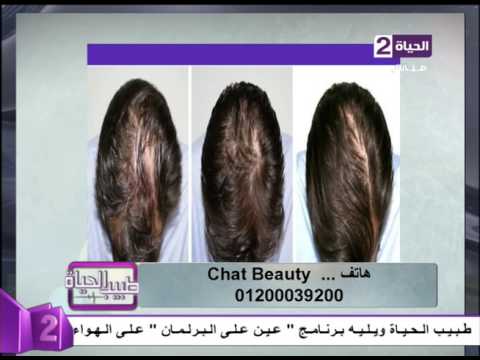 شاهد تقنية النانو في علاج تساقط الشعر