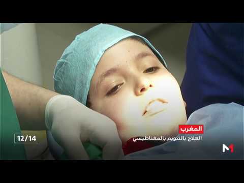 شاهد التنويم المغناطيسي لعلاج بعض الأمراض العضوية والنفسية