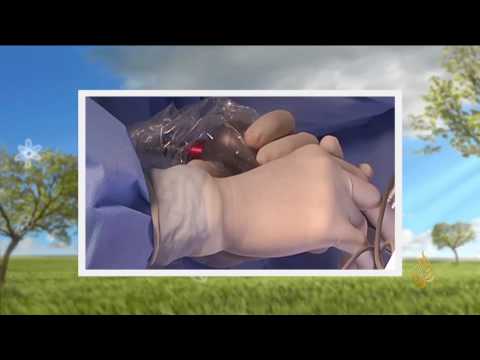 طبيب أردني يجري جراحة نادرة للانزلاق الغضروفي