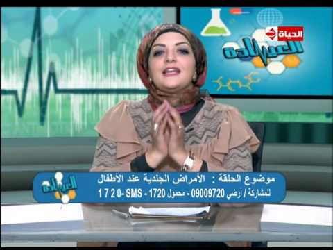 تعرف علي أسباب ظهور حب الشباب وكيفية علاجها