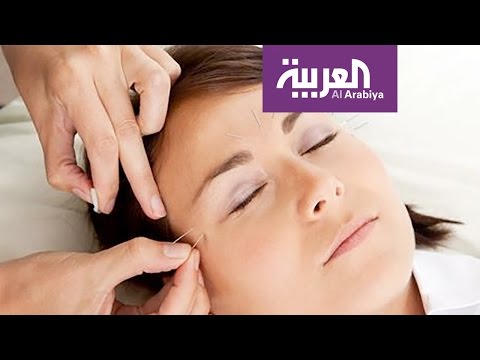 الإبر الصينية تعالج العقم والإدمان وتسد الشهية
