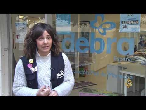 شاهد جلد الفراشة مرض وراثي نادر