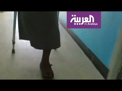 الملك سلمان للإغاثة يوفر العلاج للذين فقدوا أطرافهم