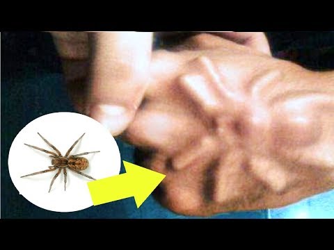 أغرب 10 أشياء وجدت داخل الجسم البشري