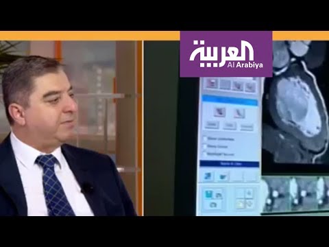 أسباب الشيب المبكر وعلاقتها أمراض القلب