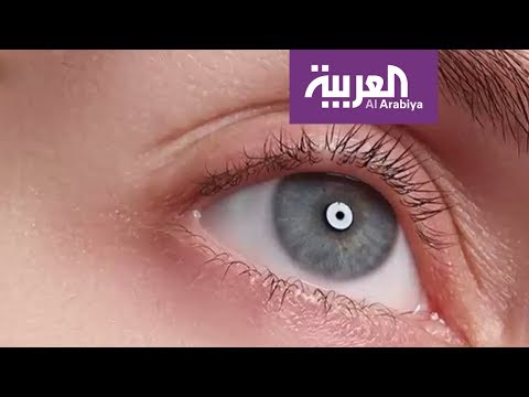 سبب ظهور الهالات السوداء تحت العينين