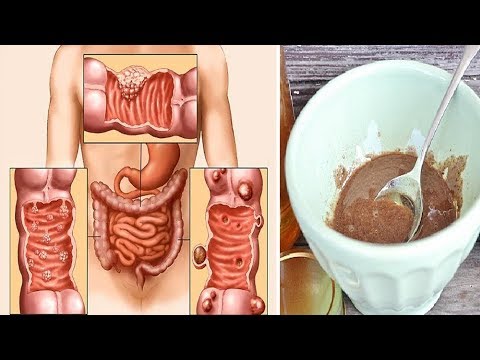 شاهد وصفة جديدة لتنظيف القولون نهائيًا من التراكمات