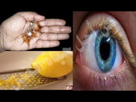 شاهد وصفة جديدة للقضاء  على ضعف النظر خلال أيام