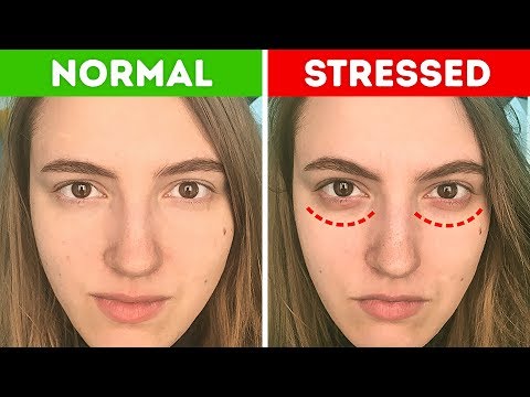 10 علامات إذا ظهرت عليك تحتاج إلى راحة