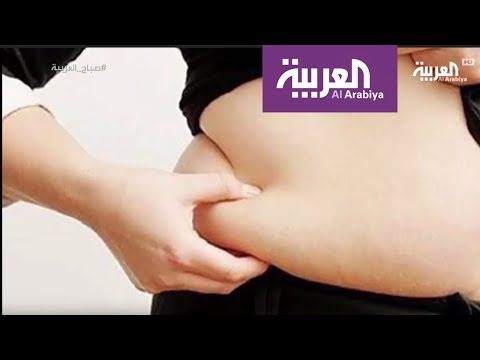 شاهد جراحة السمنة تتم للمريض إذا تجاوزت الزيادة 30 كلغ