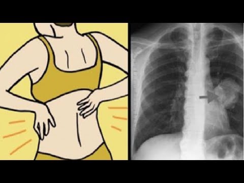 شاهد أعراض إذا ظهرت عليك راجع الطبيب فورًا