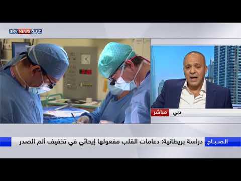 شاهد دراسة تشكك بفعالية دعامات القلب بتخفيف الألم