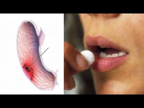 دواء يزيد من خطر الإصابة بسرطان المعدة 5 مرات