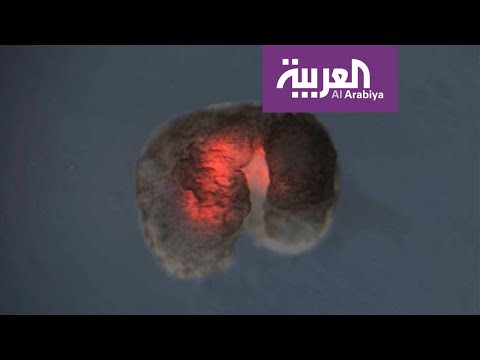 اختراع جديد لقتل الخلايا السرطانية