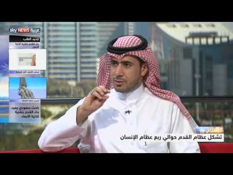 طبيب سعودي يعيد بناء القدم بتقنية ثلاثية الأبعاد