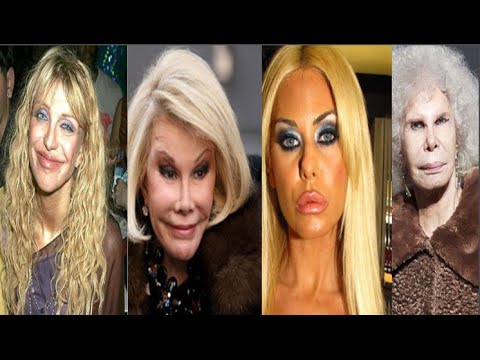 شاهدحالات صادمة لأسوأ عمليات التجميل بين المشاهير