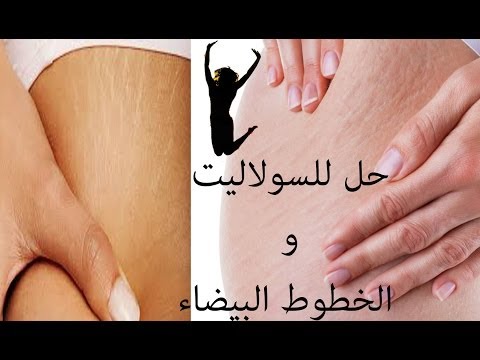 بالفيديو خلطة طبيعية تخلصك من السيلوليت