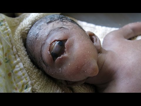 5 أطفال لن تصدق وجودهم حقًا