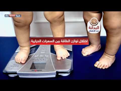 شاهد ارتفاع السكري والقلب والمفاصل بين الأطفال البدناء