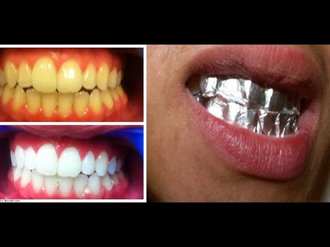 وصفة سحرية لتبييض أسنانك خلال ساعة  فقط